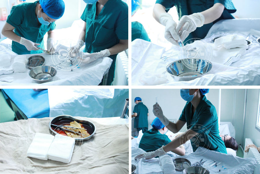 长春博润皮肤病医院东北首台RECELL细胞再生术大面积祛白手术成功